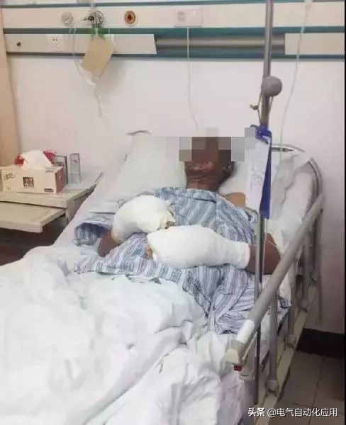 静电不会致命但会造成二次伤害,静电危害有几种情况