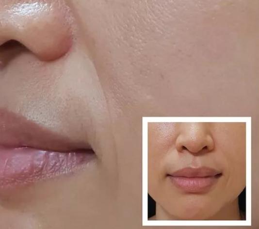 一次解决法令纹的方法,改善法令纹一看就学会