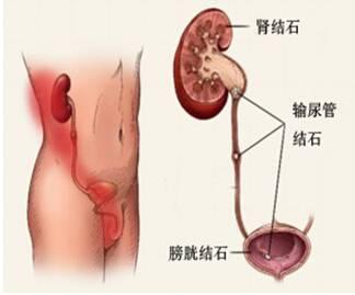 腰部右侧皮肤痒疼怎么回事,经常腰部酸疼是怎么回事