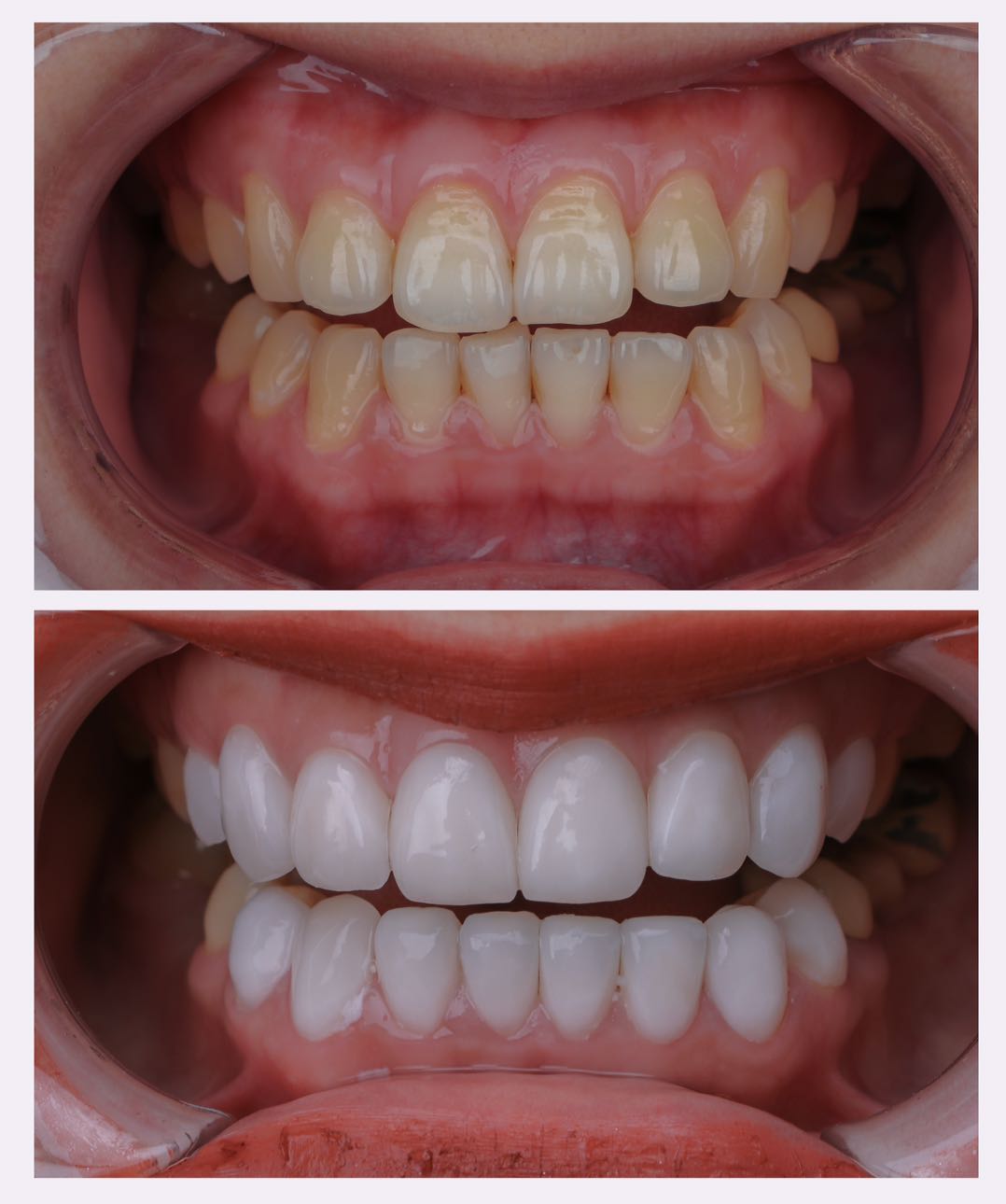 整容不如整牙真的假的,不要整容要整牙