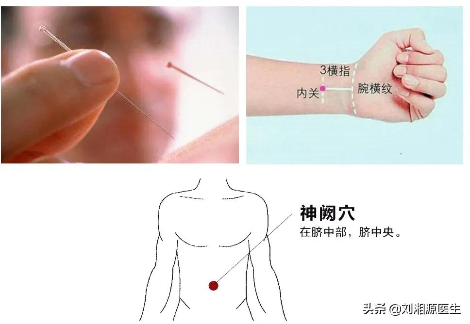 免疫不良反应科普,免疫导致不良妊娠怎么干预