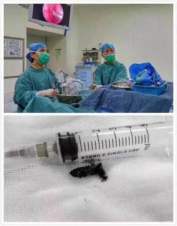 孩子有个小毛病是高智商表现,小孩从小智商发育不正常是什么病