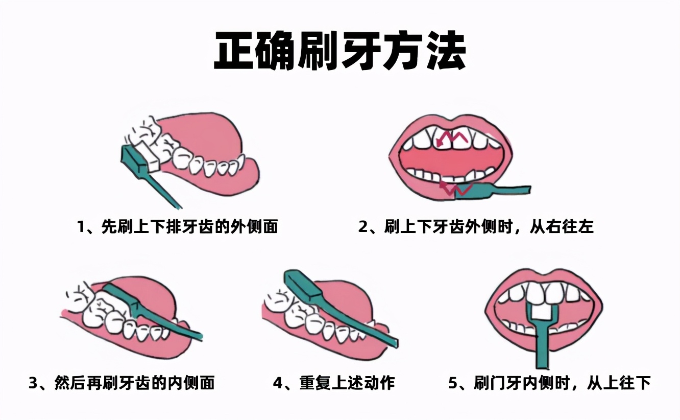 孕期牙疼智齿发炎怎么办,孕期智齿发炎只能硬抗