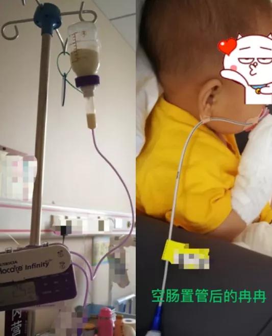 6个月宝宝消化道出血症状,6个月宝宝吐血怎么回事