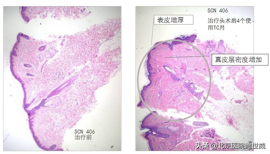 了解抗衰老护肤品,热玛吉抗衰2019