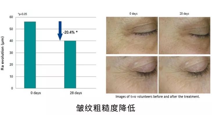 关晓彤有没有黑眼圈,关晓彤黑眼圈困扰