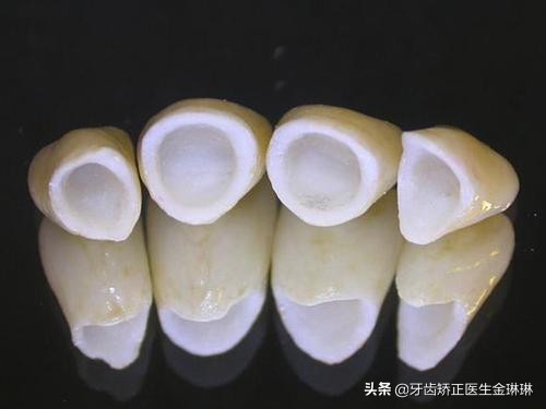 山东烤瓷牙什么牌子好,淄博市烤瓷牙价格