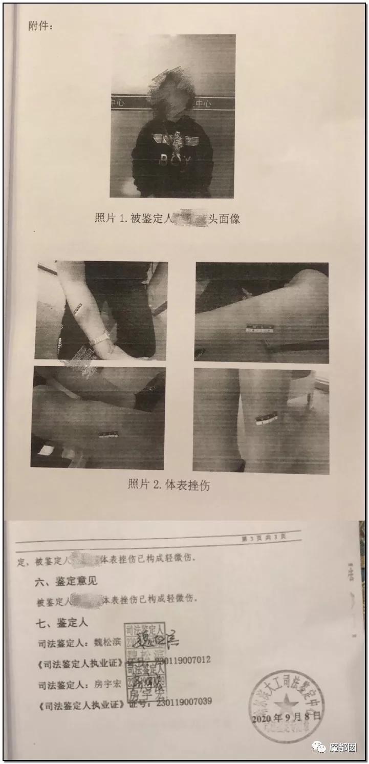 短跑名将张培萌家暴事件,短跑名将张培萌被控家暴