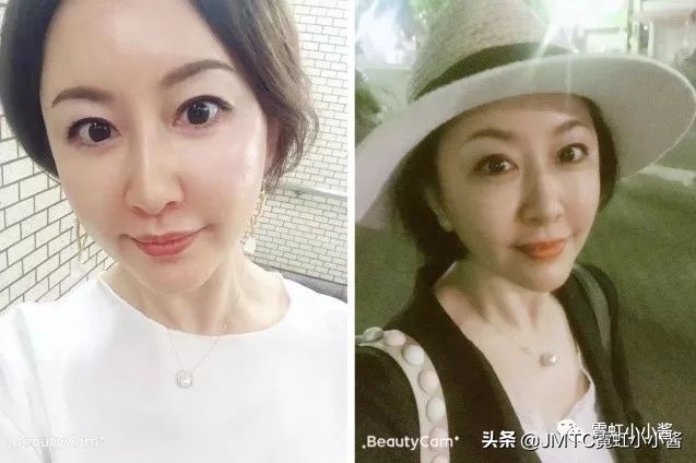 日本小姐姐针灸瘦脸视频,小姐姐打瘦脸针视频