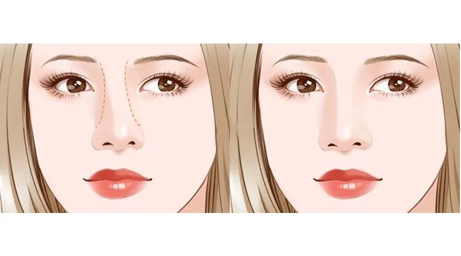 怎么日常改变鼻型,鼻型不好看怎么调整