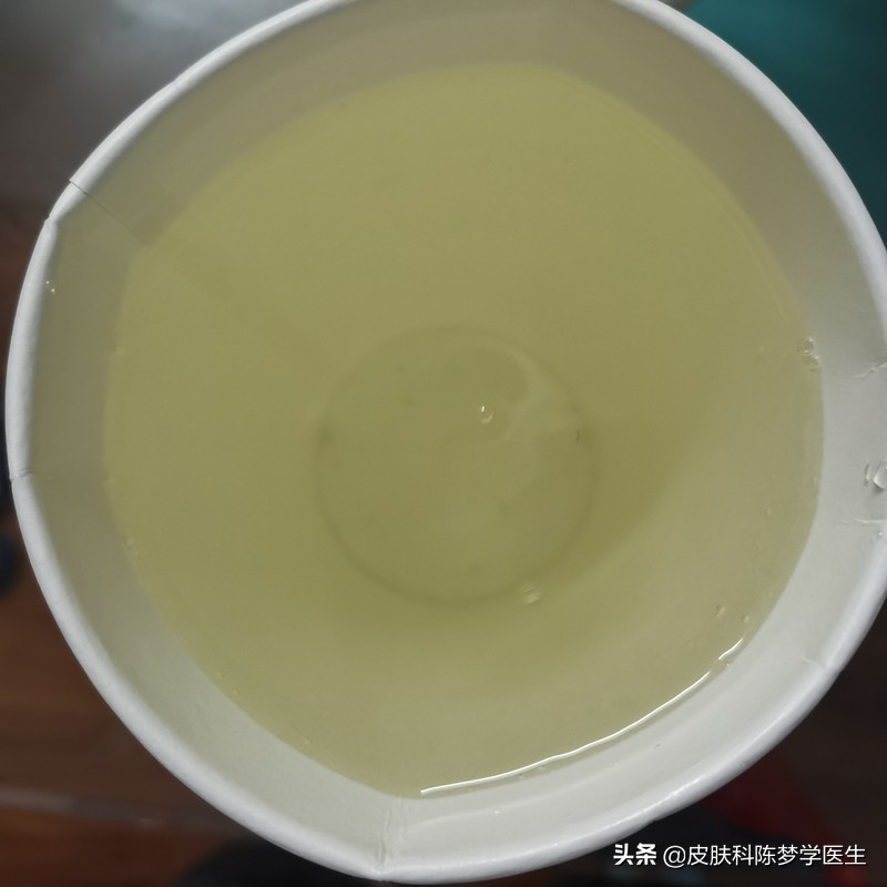 医生无麻醉给自己做了个胃肠镜,我是医生免费观看完整版