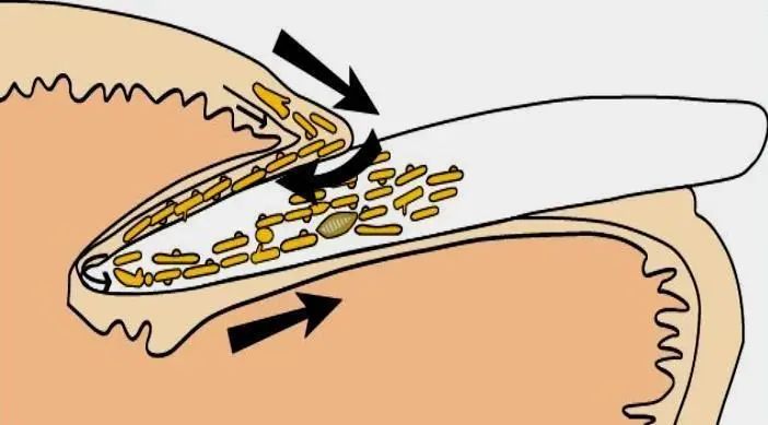 女人美甲到底该不该做,美甲指甲表面开裂是怎么回事