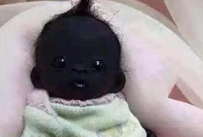 被称为世界上最黑的婴儿,世界上最黑的婴儿现在长什么样子