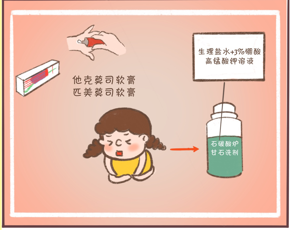 冬季湿疹反复瘙痒,肛周瘙痒湿疹反复发作怎么办