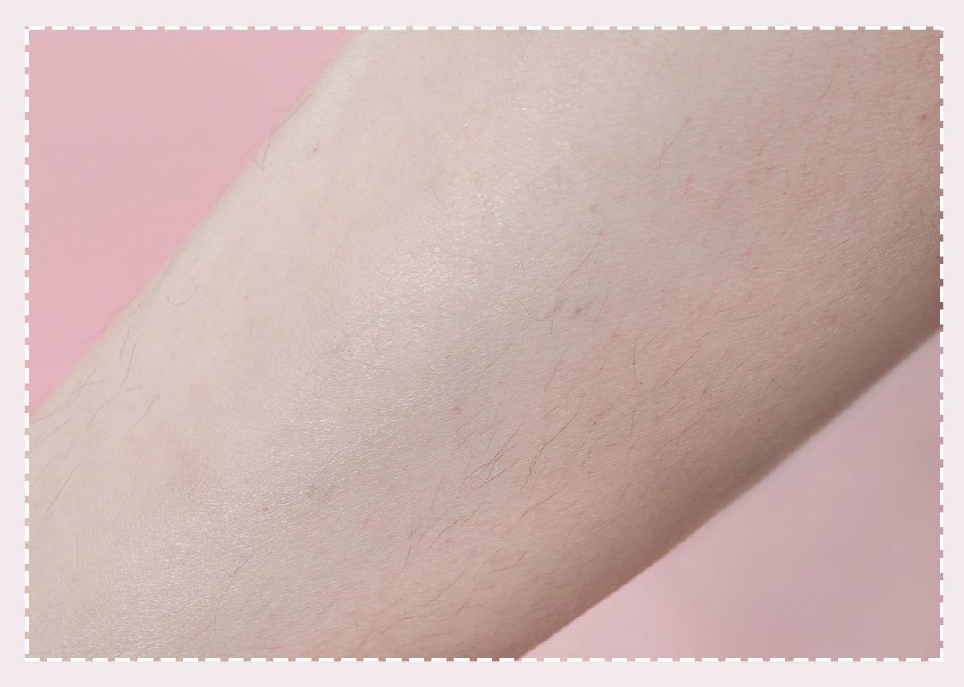 体毛脱毛的效果怎么样,天生体毛旺盛的人正常吗