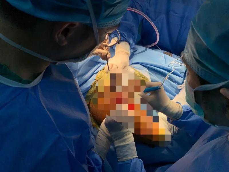 医务人员感染新冠人数,全国3387例医务人员感染新冠肺炎