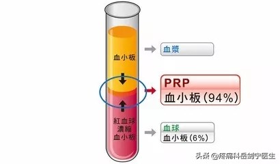 36岁膝关节疼痛一招自愈,膝关节痛中医多久可以治愈