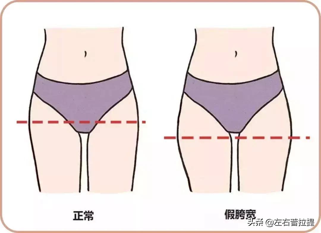 假胯宽普拉提怎样训练,假胯宽练普拉提注意事项