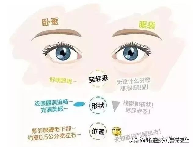 46岁做眼袋还需要做卧蚕吗,现在都把眼袋叫卧蚕了吗