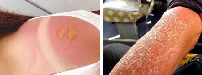 紫外线防晒冰袖,防紫外线最好的防晒袖