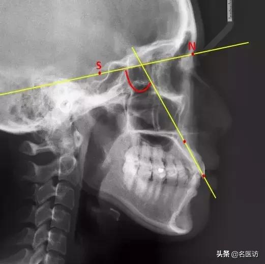 矫正牙科普馆,矫正牙齿科普知识