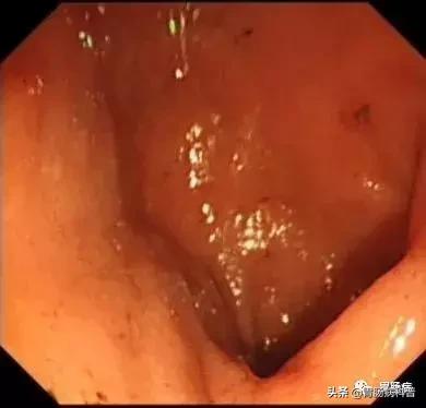 乱吃药伤肝了怎么办,吃药导致出血不止怎么处理