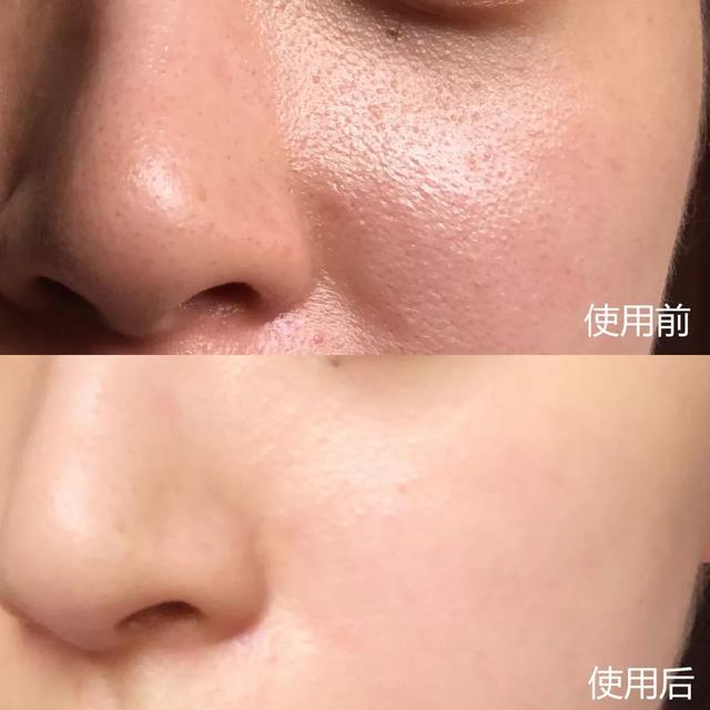 角质去得好，还你水润清透嫩白肌！小众也变“SK-II”！