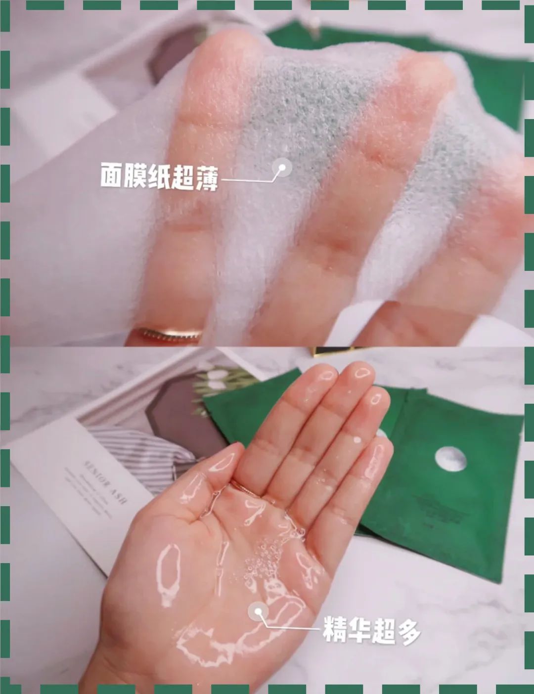 过敏长痘护肤品,一戴口罩脸过敏发痒发红怎么治