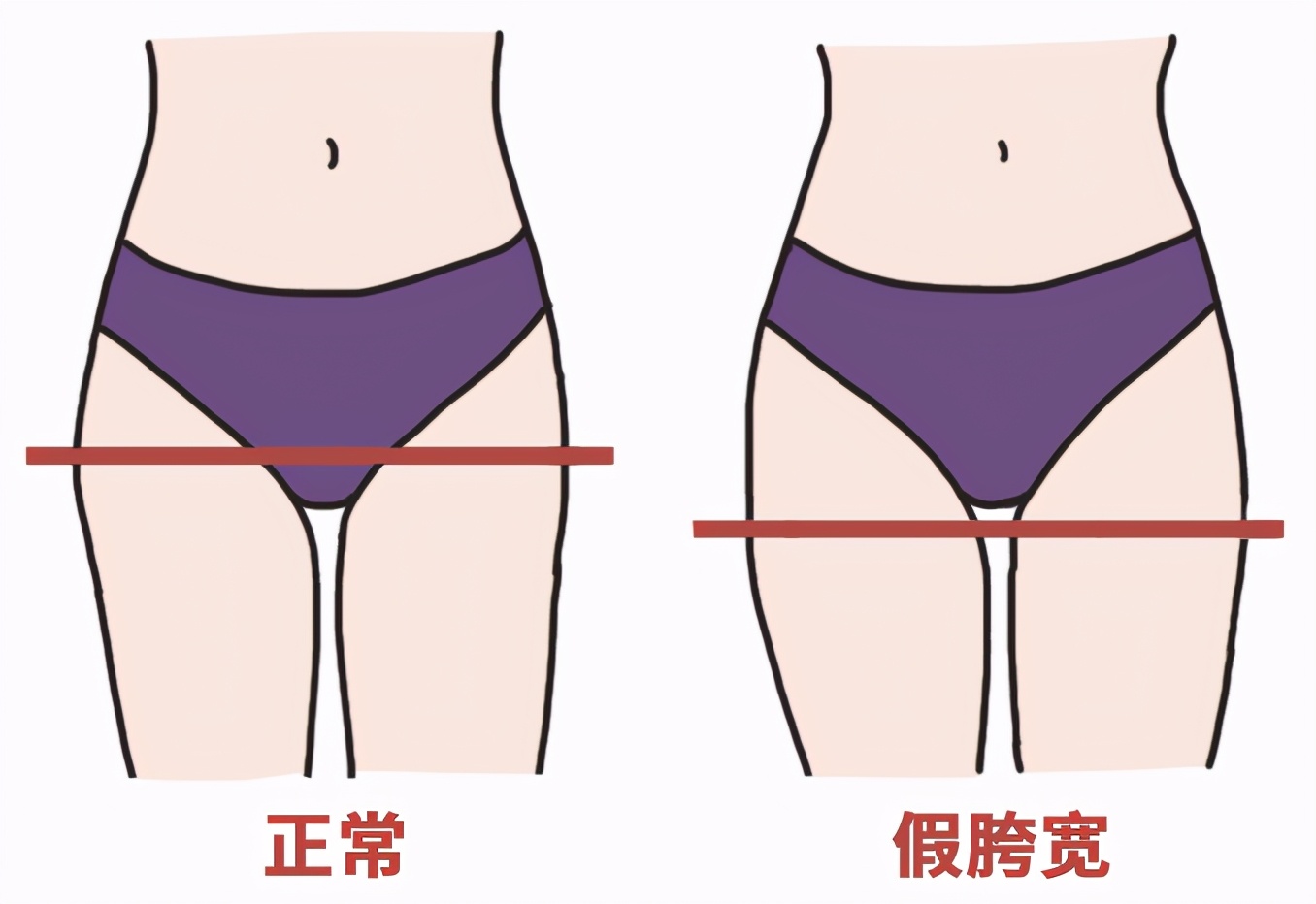 大腿粗是胖还是假胯宽？六个动作搞定，瘦下来超简单