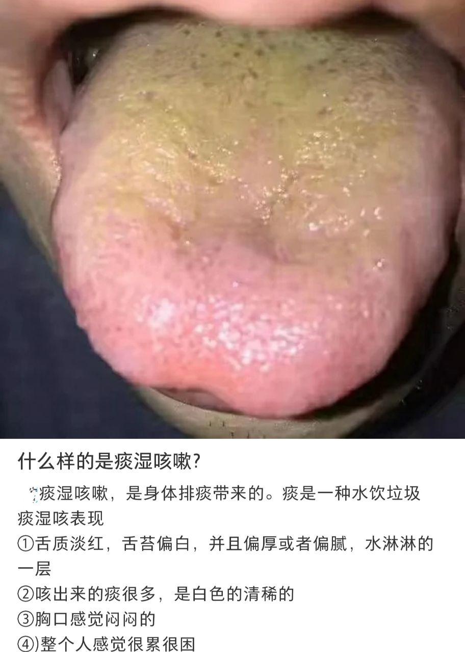 气温下降咳嗽,气温下降就咳嗽喘不过气