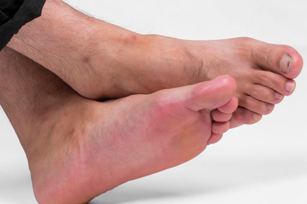 脚指甲往肉里长，走路还很疼？怎么办？