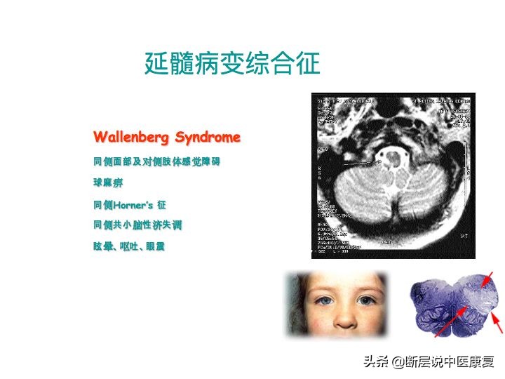 中枢神经系统断层解剖讲解,中枢神经3d解剖动画