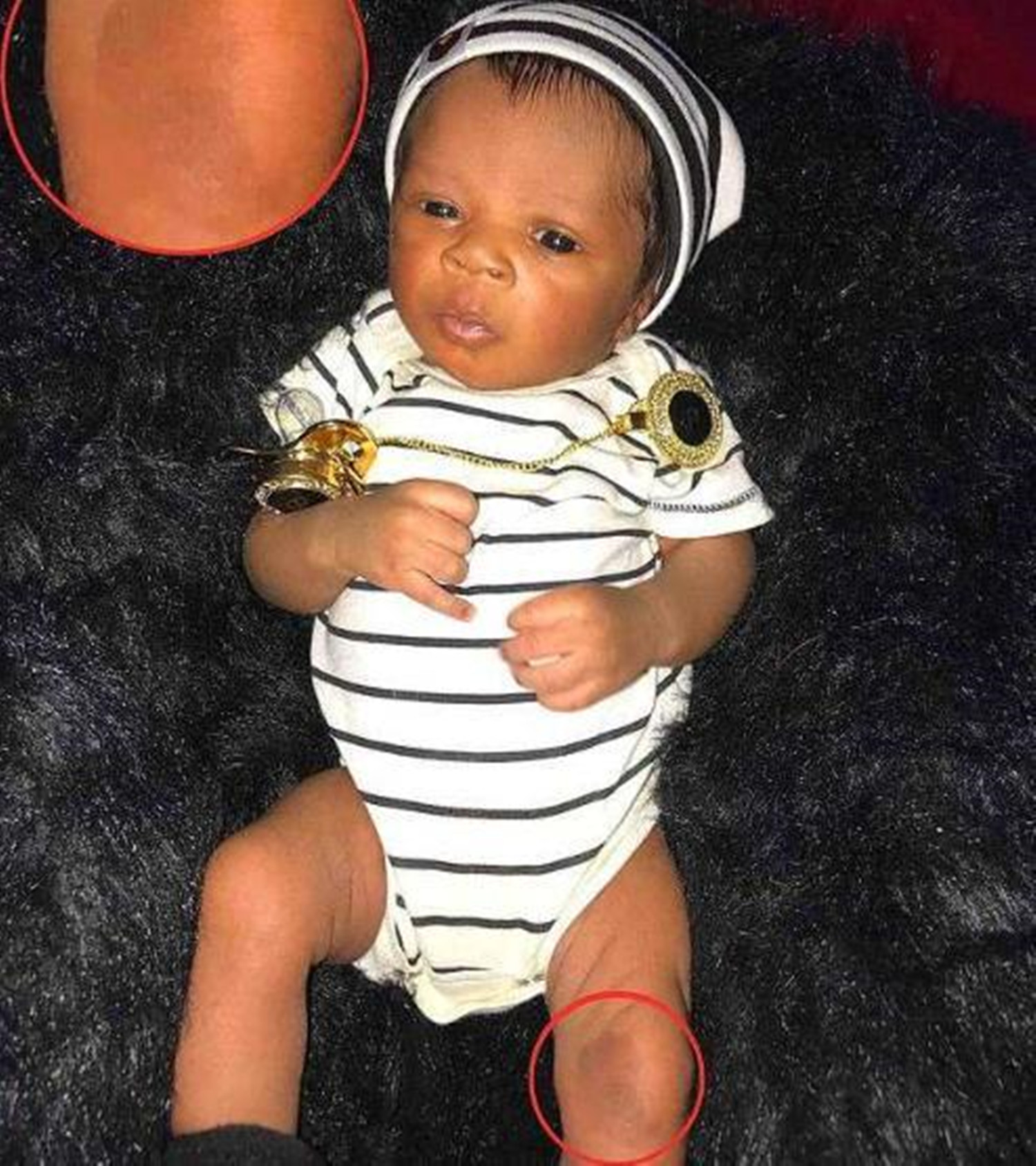 龙凤胎姐姐器官移植给弟弟,龙凤胎姐姐给弟弟移植器官