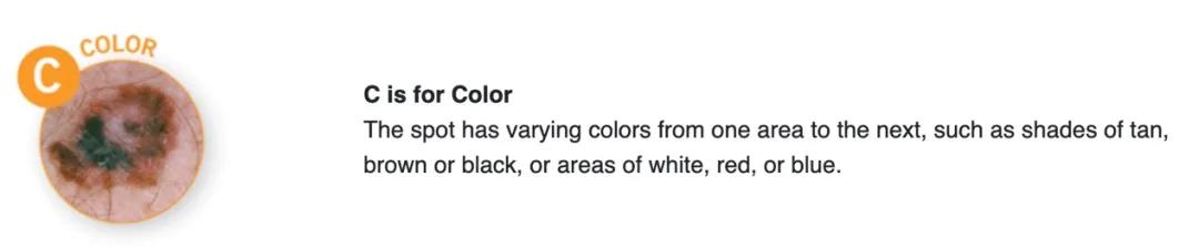 宝宝刚长出来的痣怎么消除,婴儿先天的痣容易癌变