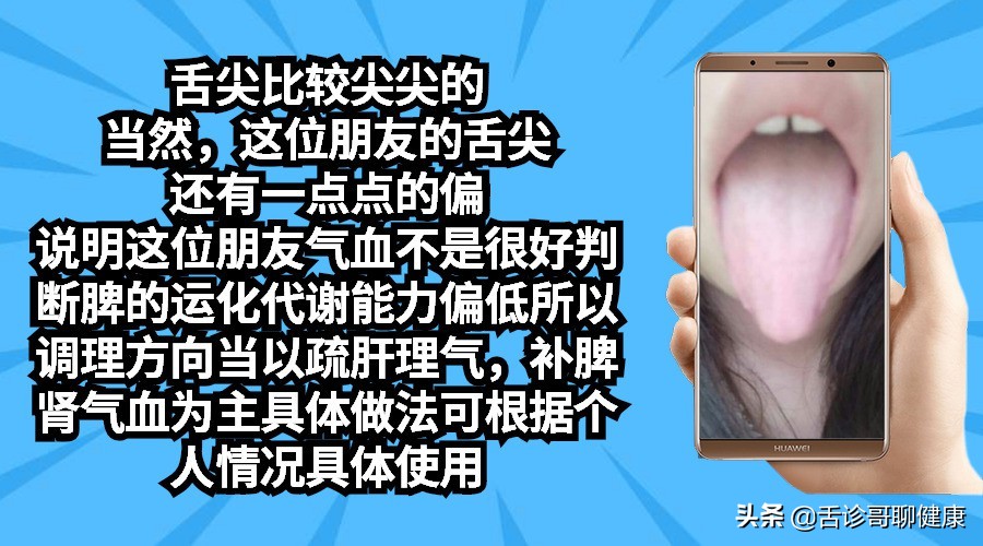 舌诊哥：遗精滑精、气短、虚汗、紧张、焦虑等舌象分析