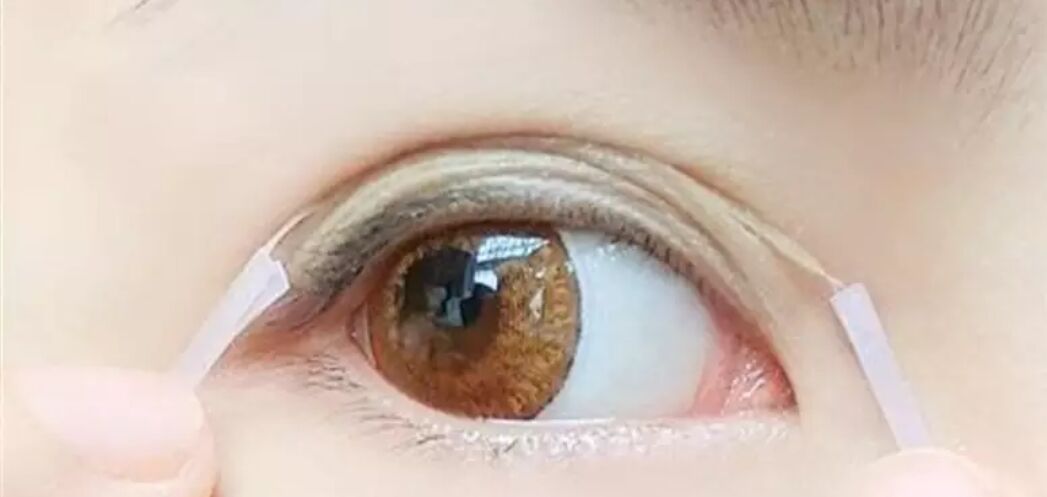 摘下眼镜就感觉双目无神,担心眼睛失明