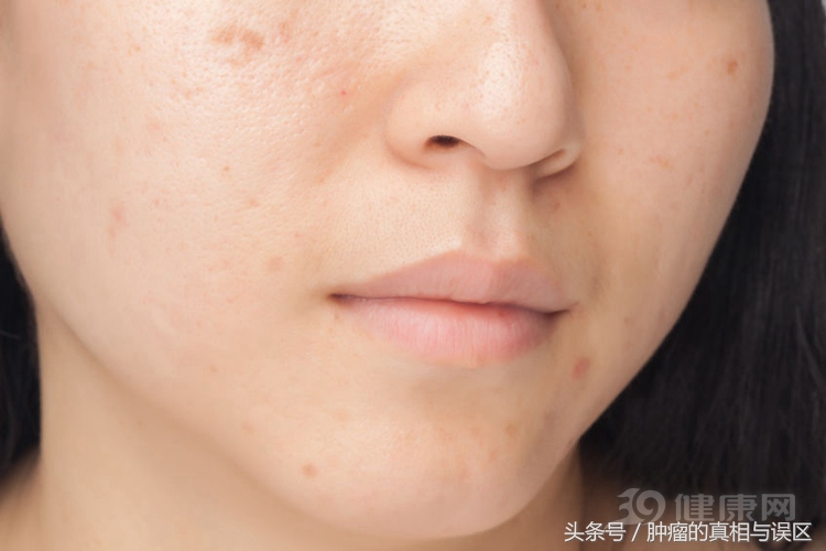 内分泌科忠告,治内分泌的中药忌口