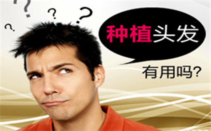 种头发靠谱吗真的有用吗,种头发的好处
