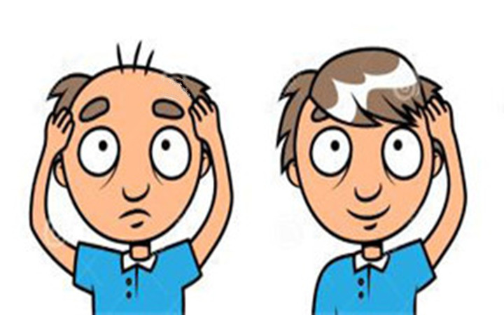 种头发靠谱吗真的有用吗,种头发的好处