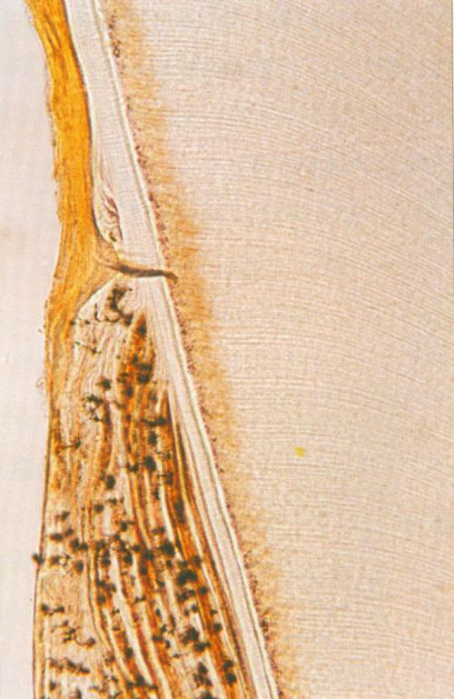 牙髓牙神经位置图,牙髓牙神经在哪里