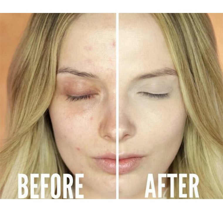 不管你化妆还是素颜,化妆新手怎么涂遮瑕