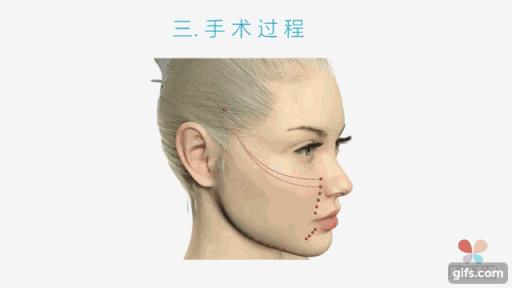 最基础最全面的医美项目是什么,有哪些比较好的医美项目