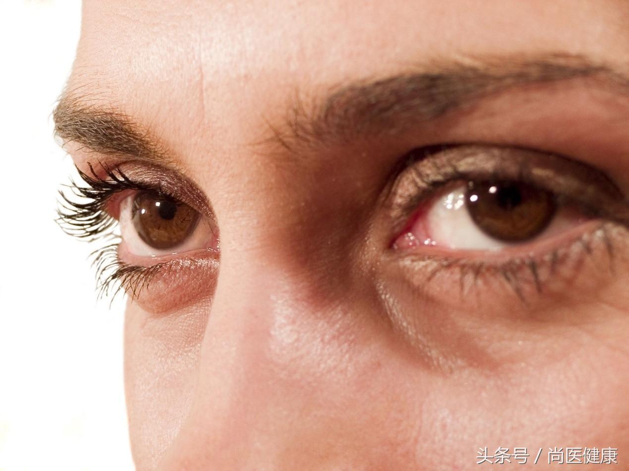 眼睛周围有脂肪粒可以冷冻去除吗,眼睛周围的脂肪粒怎么去除图片