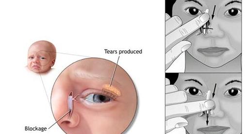 埋地雷儿童,埋地雷的小孩