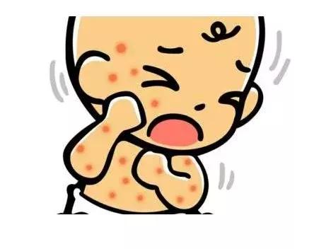 荨麻疹适合哪种益生菌,荨麻疹吃药控制住了突然又加重