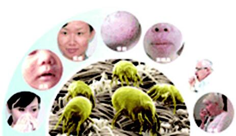 皮肤痒有螨虫怎么治疗,春天皮肤痒是过敏还是有螨虫