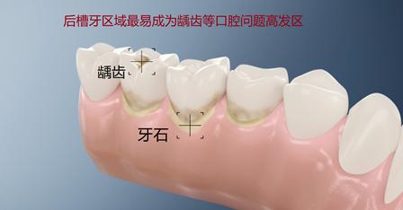 清洁钻石的方法,专门清洁牙齿顽固污渍