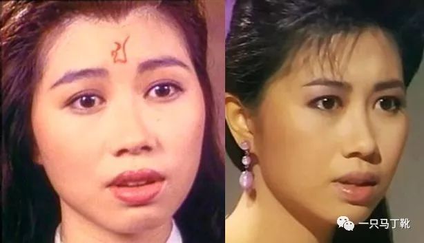 凸下巴凹面型脸怎么改变,脸宽但下巴尖怎么瘦下来