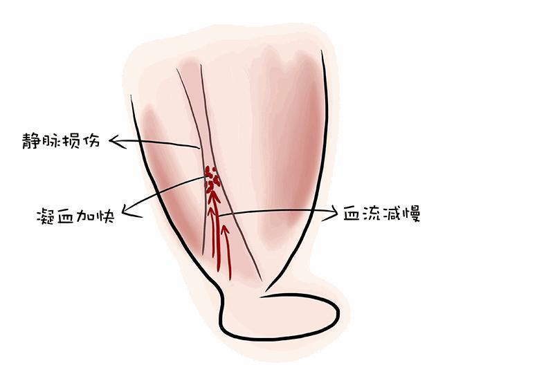 没有纤细的脚踝，就不要学杨幂“穿九分裤露脚踝显瘦”