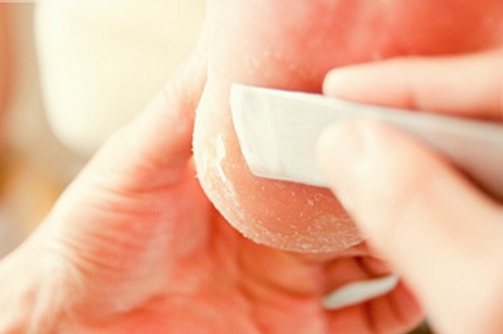 脚裂个口子总是不愈合,脚跟裂怎么办